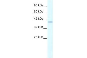Image no. 2 for anti-phosphorylase Kinase, gamma 2 (Testis) (PHKG2) antibody (ABIN631242)