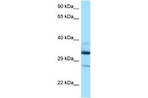 Image no. 1 for anti-Deoxyhypusine Hydroxylase/monooxygenase (DOHH) (N-Term) antibody (ABIN2788610)