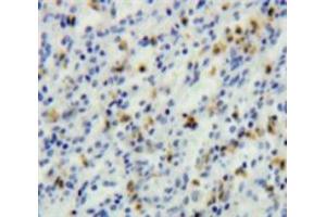 Image no. 3 for anti-T-Cell Leukemia/lymphoma 1A (TCL1A) (AA 1-114) antibody (ABIN1860692)