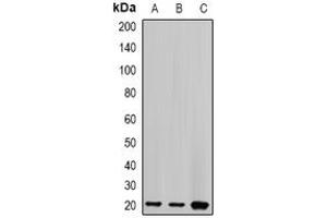 Image no. 2 for anti-Centrin, EF-Hand Protein, 2 (CETN2) (full length) antibody (ABIN6005128)