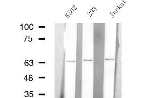Image no. 2 for anti-Arylsulfatase E (ARSE) antibody (ABIN6256951)