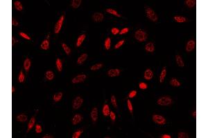 Image no. 2 for anti-Goosecoid Homeobox (GSC) (N-Term) antibody (ABIN6925929)