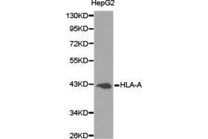 Image no. 1 for anti-Major Histocompatibility Complex, Class I, A (HLA-A) antibody (ABIN1873024)