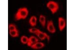 Image no. 1 for anti-Ribosomal Protein S3A (RPS3A) antibody (ABIN3198299)