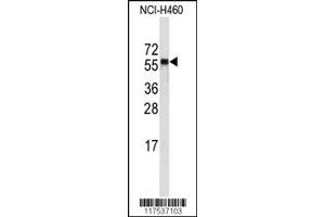 Western Blotting (WB) image for anti-Cytochrome P450, Family 4, Subfamily A, Polypeptide 11 (CYP4A11) antibody (ABIN2158461)
