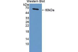 Image no. 2 for anti-Protein Inhibitor of Activated STAT, 3 (PIAS3) (AA 11-280) antibody (ABIN1869799)