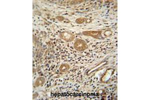 Image no. 1 for anti-Cathepsin A (CTSA) (AA 25-53), (N-Term) antibody (ABIN951063)