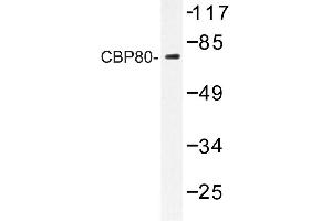 Image no. 1 for anti-Nuclear Cap Binding Protein Subunit 1, 80kDa (NCBP1) antibody (ABIN272218)