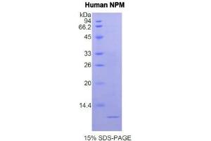 Image no. 1 for Nucleophosmin (Nucleolar phosphoprotein B23, Numatrin) (NPM1) (AA 204-290) protein (His tag) (ABIN1877267)