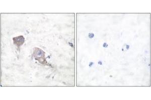 Image no. 2 for anti-Synaptosomal-Associated Protein, 25kDa (SNAP25) (AA 151-200) antibody (ABIN1533400)