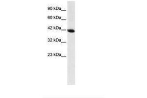 Image no. 1 for anti-Homeobox A13 (HOXA13) (AA 80-129) antibody (ABIN6735847)