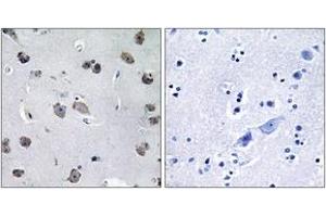 Image no. 1 for anti-TNF Receptor-Associated Factor 3 Interacting Protein 1 (TRAF3IP1) (AA 221-270) antibody (ABIN1534467)