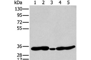 Western blot analysis of 231 Mouse heart tissue Human fetal brain tissue Jurkat and Hepg2 cell using HOXC11 Polyclonal Antibody at dilution of 1:250