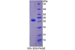 Image no. 1 for Carnitine Palmitoyltransferase 1B (Muscle) (CPT1B) (AA 602-772) protein (GST tag,His tag) (ABIN6237098)