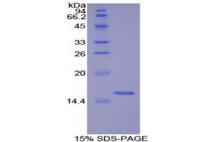 Image no. 1 for S100 Protein (S100) (AA 1-94) protein (His tag) (ABIN1171302)