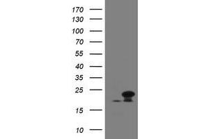 Image no. 2 for anti-NADH Dehydrogenase (Ubiquinone) 1 beta Subcomplex, 10, 22kDa (NDUFB10) antibody (ABIN1499668)