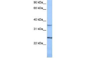 anti-Phosphatidylinositol Glycan F (PIGF) (N-Term) antibody