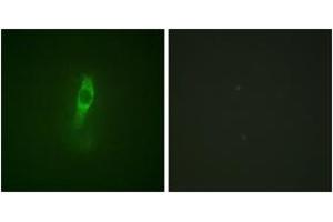 Immunofluorescence analysis of NIH-3T3 cells, using ETK (Phospho-Tyr40) Antibody.