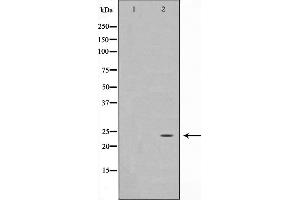 Image no. 1 for anti-Protein Phosphatase 1, Regulatory (Inhibitor) Subunit 2 (PPP1R2) (N-Term) antibody (ABIN6264386)