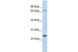 Image no. 1 for anti-Zinc Finger Protein 835 (ZNF835) (Middle Region) antibody (ABIN2775161)