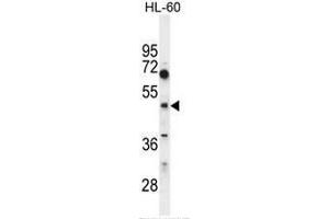 Image no. 2 for anti-Choline/ethanolamine phosphotransferase 1 (CEPT1) (AA 36-65), (N-Term) antibody (ABIN951479)