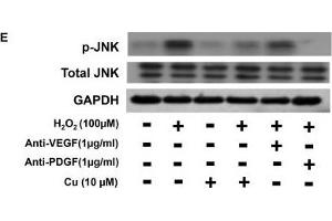 Image no. 49 for anti-Glyceraldehyde-3-Phosphate Dehydrogenase (GAPDH) (Center) antibody (ABIN2857072)