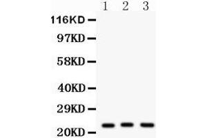 Image no. 4 for anti-Peroxiredoxin 5 (PRDX5) (AA 66-198) antibody (ABIN3043906)