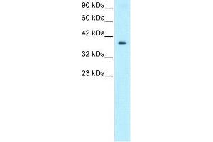 Image no. 1 for anti-5'-Nucleotidase, Cytosolic III (NT5C3) (Middle Region) antibody (ABIN1108495)
