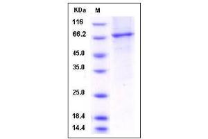 Image no. 1 for phosphodiesterase 2A, CGMP-Stimulated (PDE2A) (AA 215-900) protein (His tag) (ABIN2005384)