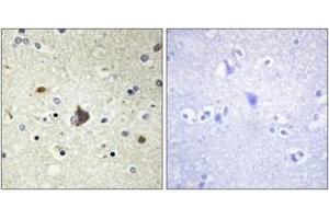 anti-Collagen, Type IV, alpha 3 (COL4A3) (AA 801-850) antibody