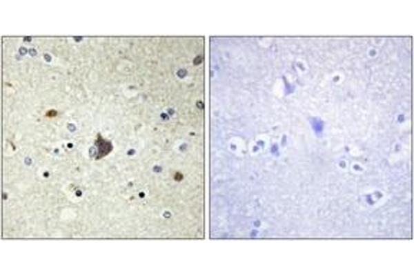 anti-Collagen, Type IV, alpha 3 (COL4A3) (AA 801-850) antibody