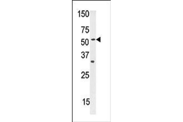 anti-Solute Carrier Family 29 (Nucleoside Transporters), Member 1 (SLC29A1) (AA 402-431), (C-Term) antibody