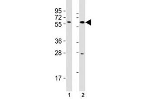Image no. 5 for anti-SRY (Sex Determining Region Y)-Box 10 (SOX10) (AA 231-259) antibody (ABIN3032721)