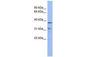 Image no. 1 for anti-Hairy/enhancer-of-Split Related with YRPW Motif 2 (HEY2) (C-Term) antibody (ABIN6742819)