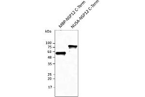 SARS-CoV-2 NSP12 (RdRP) anticorps  (C-Term)