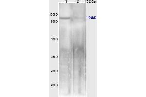 Image no. 2 for anti-Mitogen-Activated Protein Kinase Kinase Kinase 14 (MAP3K14) (AA 901-947) antibody (ABIN724520)