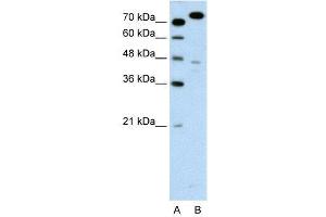 Image no. 1 for anti-Minichromosome Maintenance Complex Component 3 (MCM3) (C-Term) antibody (ABIN2774880)