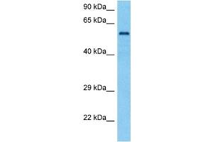 Image no. 4 for anti-Tyrosinase-Related Protein 1 (TYRP1) (Middle Region) antibody (ABIN2781815)
