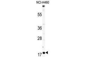 Image no. 1 for anti-Ribosomal Protein L23A (RPL23A) (Middle Region) antibody (ABIN357268)