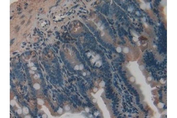 VEGFC antibody  (AA 108-223)
