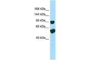 Image no. 1 for anti-Repetin (RPTN) (C-Term) antibody (ABIN2790278)