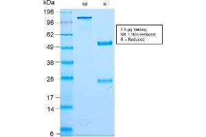 Image no. 1 for anti-Neurofilament, Light Polypeptide (NEFL) antibody (ABIN6940190)