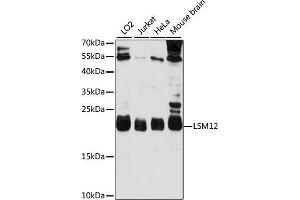 LSM12B anticorps  (AA 1-195)