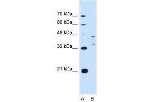 Image no. 1 for anti-Ecotropic Viral Integration Site 2B (EVI2B) (Middle Region) antibody (ABIN630385)