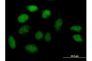 Immunofluorescence of purified MaxPab antibody to ZNF503 on HeLa cell.