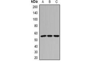 Image no. 2 for anti-Interferon-Induced Protein 44 (IFI44) antibody (ABIN3198142)