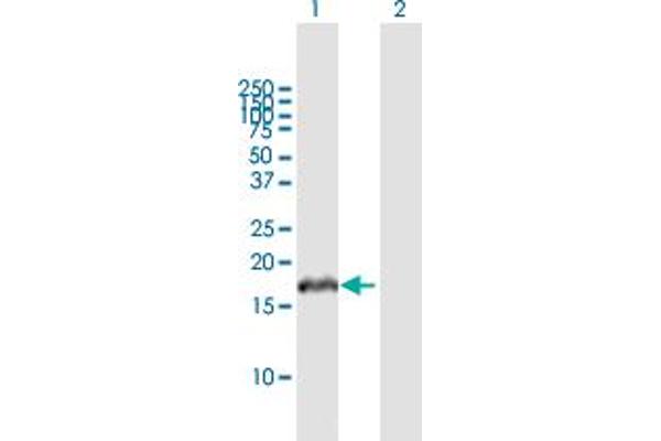 VHLL antibody  (AA 1-139)