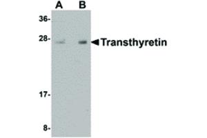Image no. 1 for anti-Transthyretin (TTR) (Internal Region) antibody (ABIN6656337)