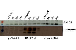 Image no. 2 for anti-Cyclin-Dependent Kinase Inhibitor 1B (p27, Kip1) (CDKN1B) (Internal Region), (pSer140) antibody (ABIN5596806)