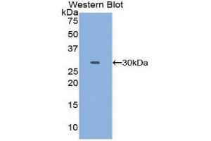 Image no. 1 for anti-DNA Topoisomerase II (TOP2) (AA 923-1148) antibody (ABIN1860829)